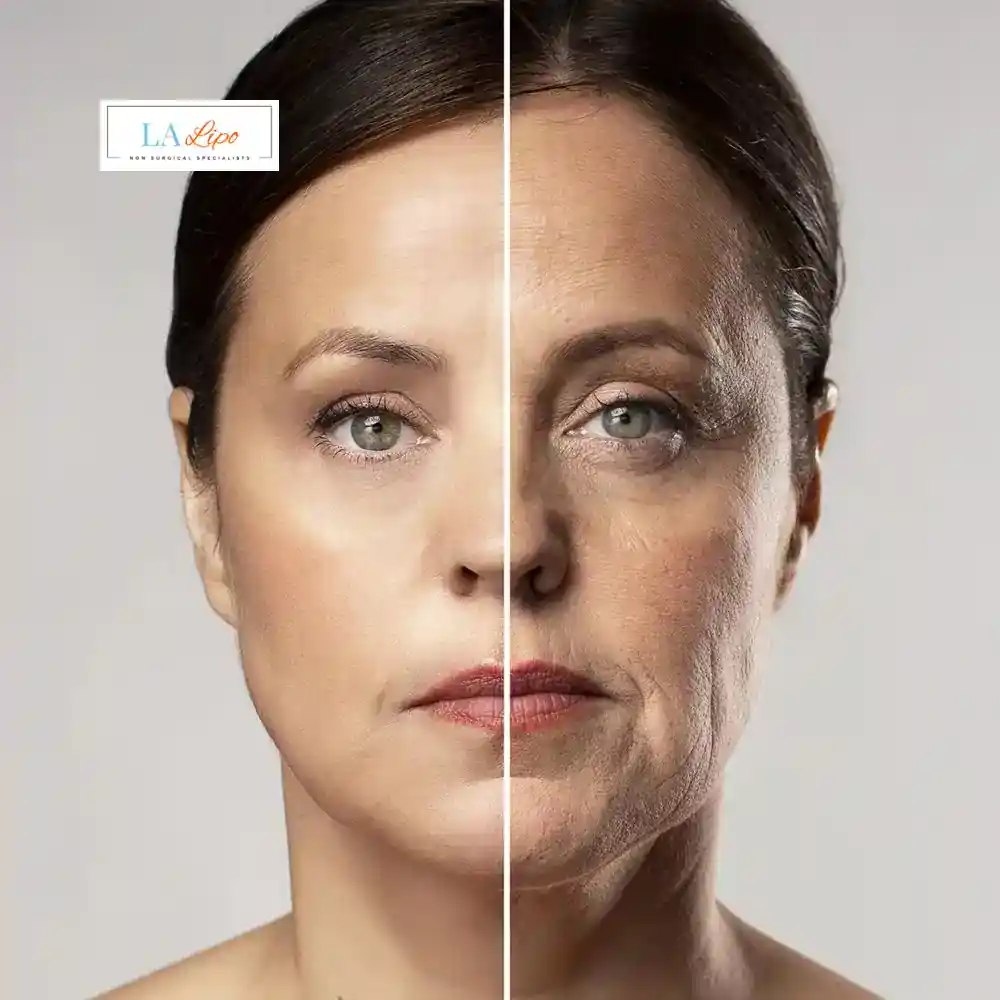 How Can You Tell If Non-Surgical Skin Tightening Is Right for You Chigwell?