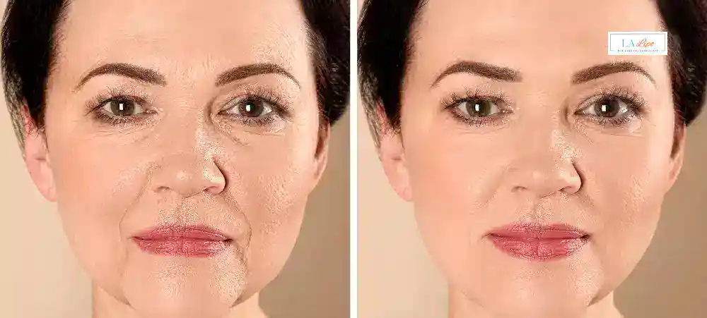 How Long Does It Take to See Results and How Long Do They Last Chigwell?